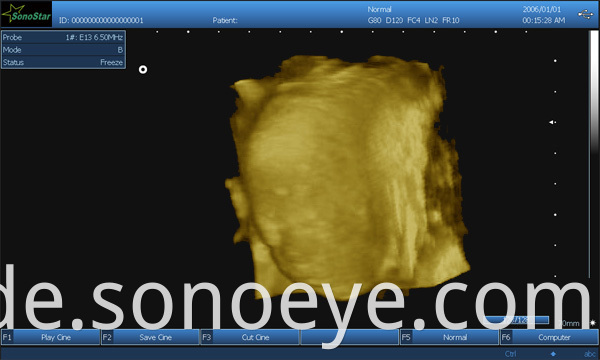 image for labtop ultrasound